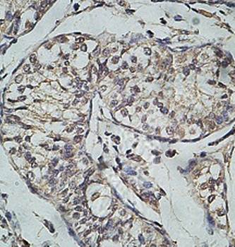 EFCAB7 Rabbit Polyclonal Antibody
