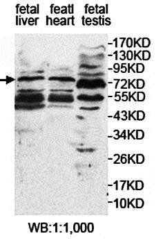 EFCAB7 Rabbit Polyclonal Antibody