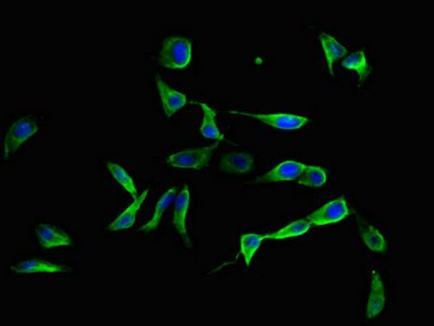 EFEMP1 Antibody
