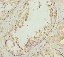 EFHC1 Antibody