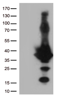 EFHD1 Antibody