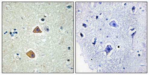 EFNA5 antibody