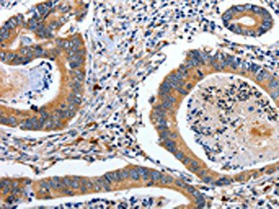 EFNB2 Antibody