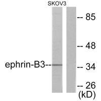EFNB3 antibody