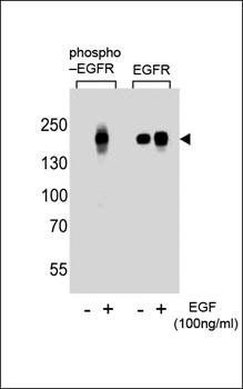 EGFR (phospho-Ser768) antibody