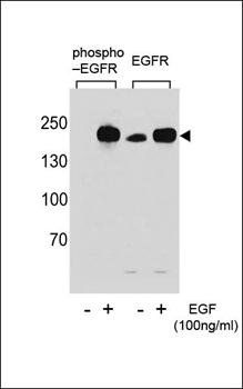 EGFR (phospho-Tyr1069) antibody