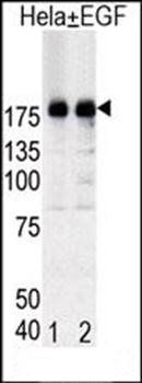 EGFR (phospho-Tyr1092) antibody