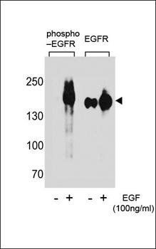 EGFR (phospho-Tyr1172) antibody