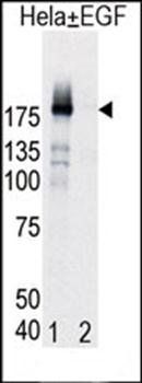 EGFR (phospho-Tyr998) antibody