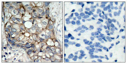 EGFR (Ab-1070) Antibody