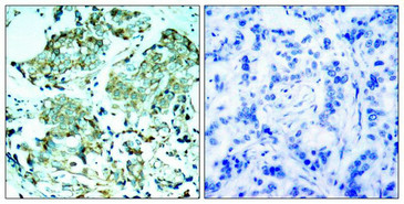 EGFR (Ab-1110) Antibody