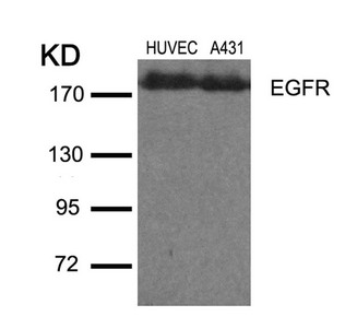 EGFR (Ab-1110) Antibody