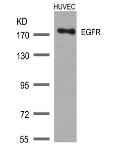 EGFR (Ab-1172) Antibody