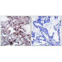 EGFR (Ab-1172) Antibody