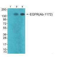 EGFR (Ab-1172) Antibody