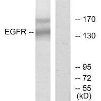 EGFR (Ab-1172) Antibody