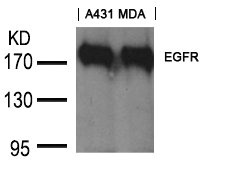 EGFR (Ab-1197) Goat Polyclonal Antibody