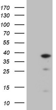 EGFR Antibody