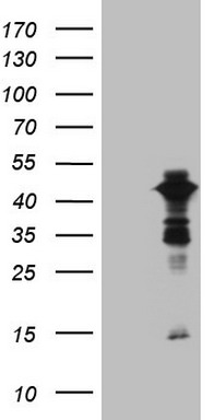 EGFR Antibody