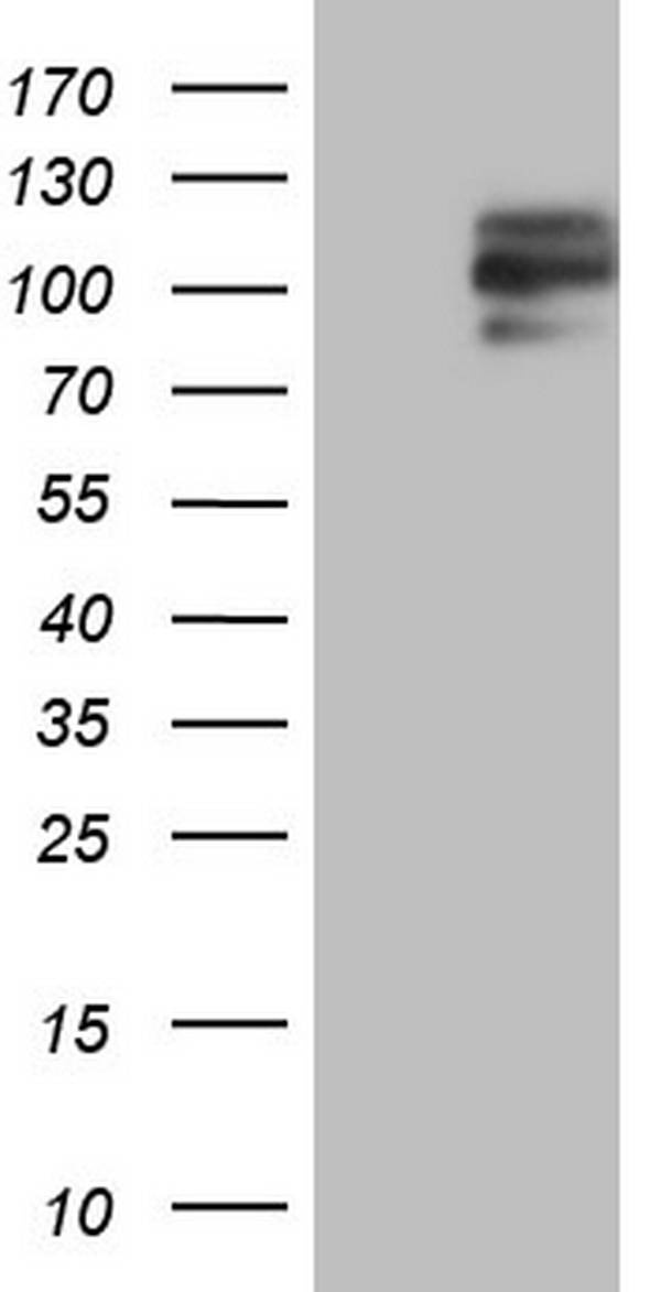 EGFR Antibody