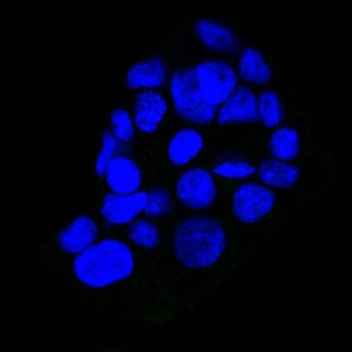 EGFR (Epidermal Growth Factor Receptor) Antibody