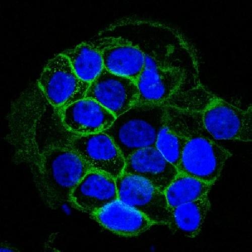 EGFR (Epidermal Growth Factor Receptor) Antibody