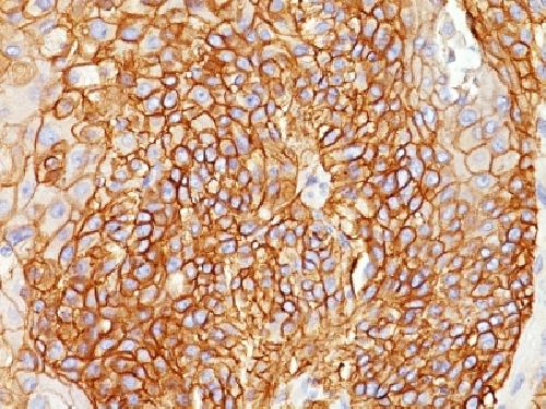 EGFR (Epidermal Growth Factor Receptor) Antibody