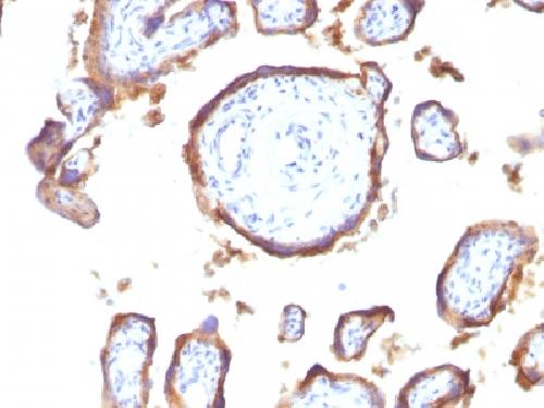 EGFR (Epidermal Growth Factor Receptor) Antibody