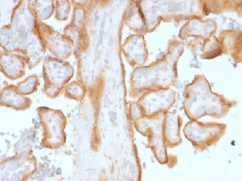 EGFR (Epidermal Growth Factor Receptor) Antibody