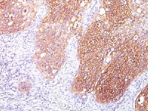 EGFR (Epidermal Growth Factor Receptor) Antibody