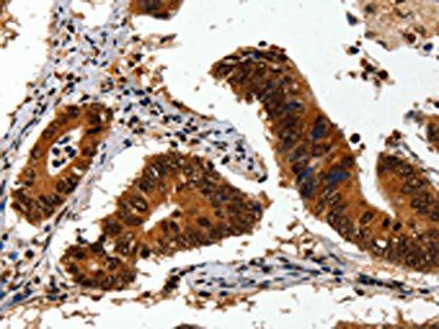 EGFR Antibody