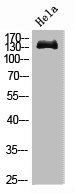 EGFR Monoclonal Antibody