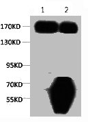 EGFR Monoclonal Antibody