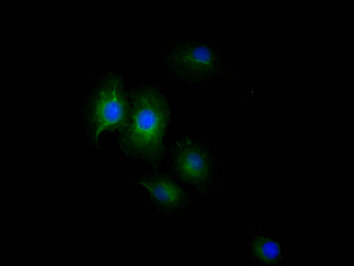 EGFR antibody