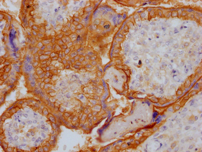 EGFR Recombinant Monoclonal Antibody