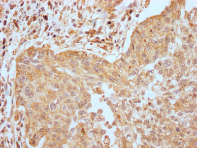 EGFR Recombinant Monoclonal Antibody