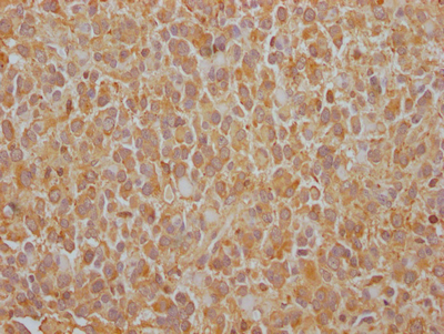 EGFR antibody