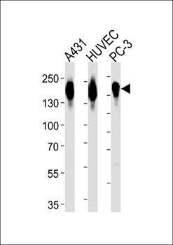 EGFR-S1026 antibody