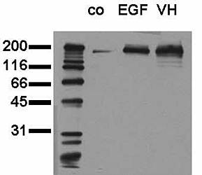 MAB TO EGFR,ACTIVATED PTYR1173