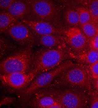 EGFR (Ab070) Antibody
