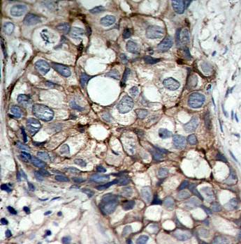 EGFR (Ab070) Antibody
