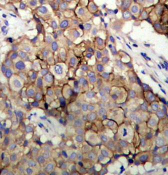 EGFR (Ab092) Antibody