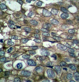 EGFR (Ab-869) Antibody
