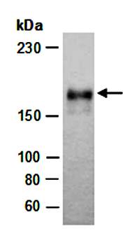 EGFR (N2) Antibody, Mouse Monoclonal