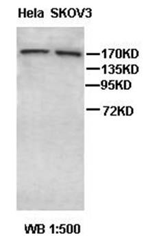 EGFR Rabbit Polyclonal Antibody