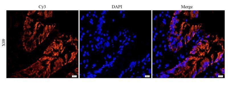 EGFR isoform a variant antibody