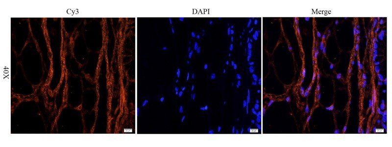 EGFR isoform a variant antibody