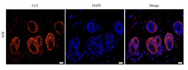 EGFR isoform a variant antibody