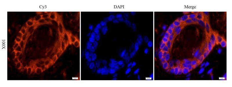 EGFR isoform a variant antibody