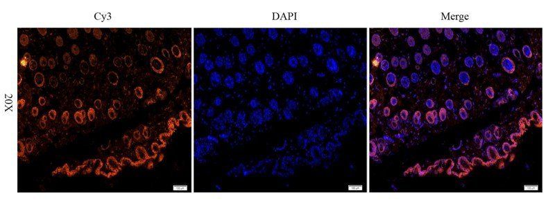 EGFR isoform a variant antibody